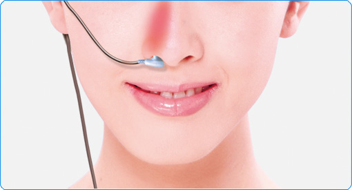 康兴三高半导体激光/低频治疗仪GX-2000A激光鼻腔照射使用方法-康兴官网