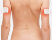 康兴三高半导体激光/低频治疗仪GX-2000B上臂按摩-康兴官网