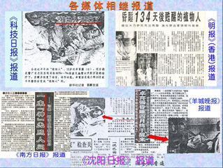 照醒了昏睡134天的“植物人”报道-康兴医疗器械官网 照醒了昏睡134天的“植物人”报道-康兴医疗器械官网
