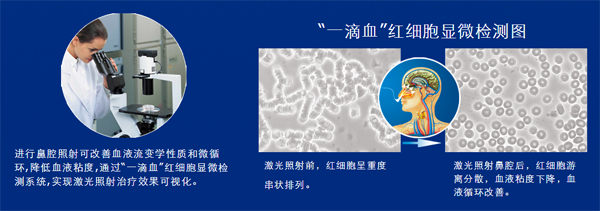 生活中哪些现象说明你的血液粘稠?-激光理疗仪“一滴血”实验-康兴医疗器械官网 生活中哪些现象说明你的血液粘稠?-激光理疗仪“一滴血”实验-康兴医疗器械官网