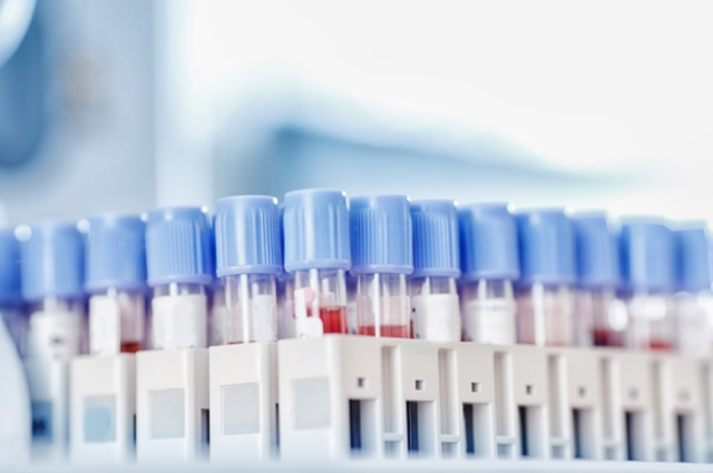 血液、抽血、体检、高血脂-康兴医疗器械官网 血液、抽血、体检、高血脂-康兴医疗器械官网