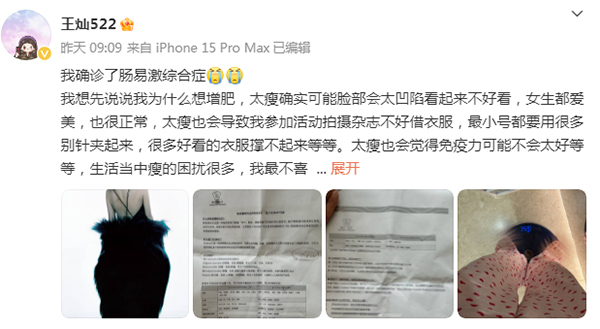 演员杜淳妻子王灿-康兴医疗器械官网 演员杜淳妻子王灿-康兴医疗器械官网