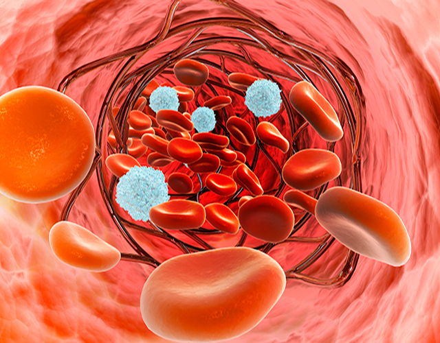 信号、硬化、动脉-康兴医疗器械官网 信号、硬化、动脉-康兴医疗器械官网