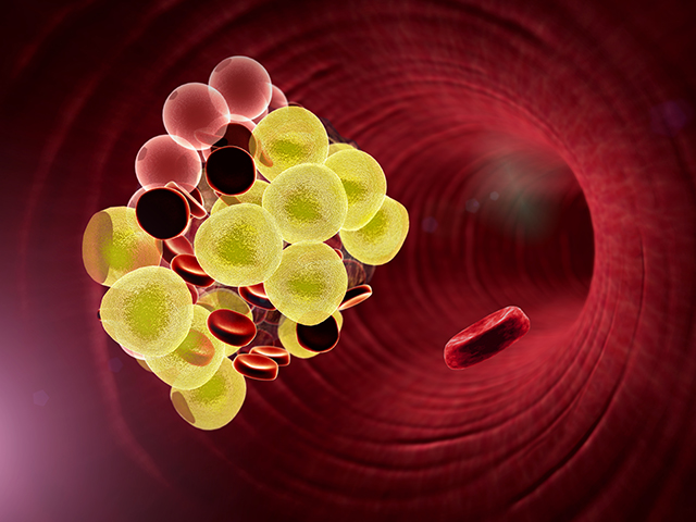 脂肪粒、内脏脂肪、身体情况-康兴医疗器械官网 脂肪粒、内脏脂肪、身体情况-康兴医疗器械官网